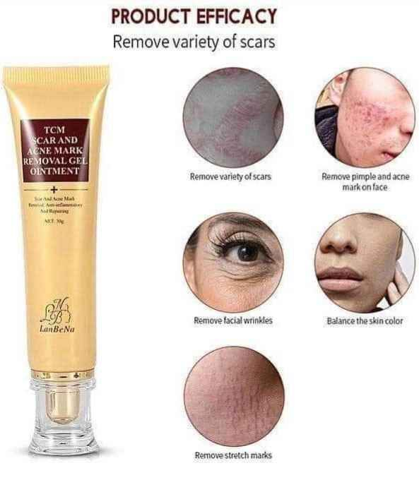منتج بريطاني فعال لوجه كالقمر ♥️المنتج السحري لأخفاء الاثار♥️

🔥بعد الإنقطاع رجع توفر الكريم اللي كل حبو لأخفاء العيوب 
💥المنتج السحري لإخفاء جميع الندبات المزعجة العلاج الامثل لحب الشباب وأثار الحروق والجروح بكافة اشكالها
💢من اجمل ما انتجته شركة لانبينا 
💢كريم لإصلاح البشرة بوقت قياسي التأثيرات : 

✅ حفرة ناتجة عن حب الشباب 
✅ ندبات بثرة 
✅ علامات لدغ الحشرات 
✅ علامة فرك وما إلى ذلك 
✅ تساعد بشكل فعال في إزالة: الحروق ، الجروح والعلامة التي تؤثر على الجمال
✅ كريم علاج اثار العمليات القيصريه 
✅ اثار علامات التمدد اثار ندبة acnes, الجلد , الحروق

🔴 lanbena tcm وكاله بريطانيه
✅ كريم ازالة الندبة من lanbena هو كريم التكنولوجيا المتقدمة, وهو يخترق بشكل فعال الجلد و ازالة التشققات
🟥يعمل بشكل فعاال جدا على تحفيز الكولاجين بالبشرة ويعمل على محاربة علامات التمدد ايضا وازالة البقع الداكنة في وقت وجيز
#الاصلي 🇬🇧💯 بغداد, العراق


**إذا كنت صاحب هذا الإعلان وتريد حذفه لأي سبب، رجاءا أرسل رسالة إلى الدعم الفني**
