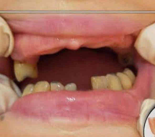 السلام عليكم 👋🏻
اي شخص فاقد 3 اسنان او اكثر ويريد يعوضهم بأسنان بشكل مجاني يرجى الاتصال برقم ***********
الموقع:الدورة_تقاطع شارع المصافي _عيادات مستشفى جامعة دجله
