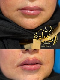 خصومات للعرائس والصديقات على الفلر وابر النضاره فقط لسكنة الشعب والاما...