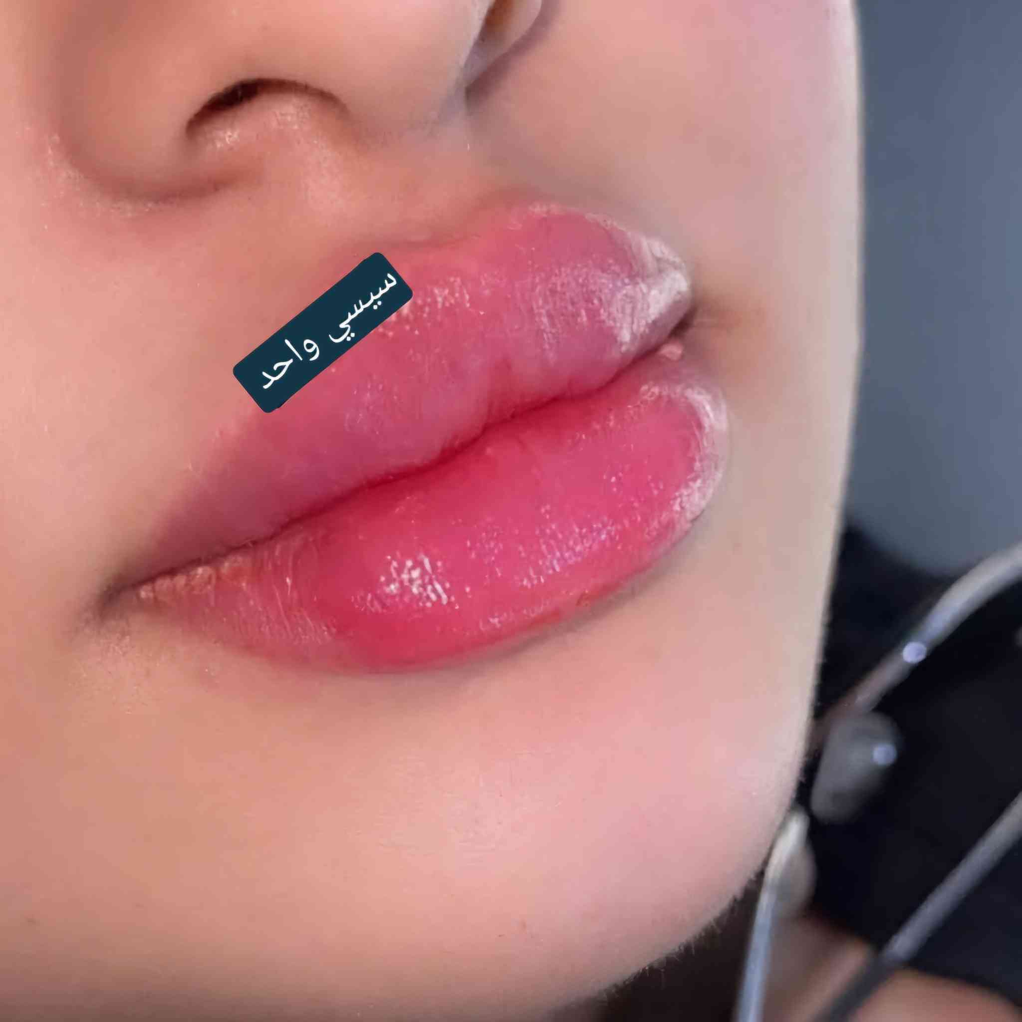 يعلن سنتر علوش  للتجميل عن عروض الفلر 🔥🔥❤️❤️
عروض راس سنه 🌲🌲🌲
 البنوتات ❤️‍🔥
كل انوع الفلر حسب ختيارج بسعر 25🤩
الفلرات (1cc)🔥💋💋💋💋💋
اراستي اي بلاس.                    (1cc)
نيوراميس تغير شامل             (1cc)
نيوراميس كوري ديب شفه     (1cc)
نيوراميس كوري فاليوم وجه   (1cc)
ميدام كوري شفه                  (1cc)
ميدام كوري وجه.                (1cc)
ابتك شفه                             (1cc)
ابتك تغير شامل.                   (1cc)
ابتك سوفت.                          (1cc)
بايوبكس وجه.                         (1cc)
بايوبكس شفه.                          (1cc)
بايوبكس سوفت.                    (1cc)
العنوان بغداد جديده نعيريه فلكة كنيسة مريم العذراء 
فرع كرزات كاجوو للحجز ☎️***********🤩
@إشارة
