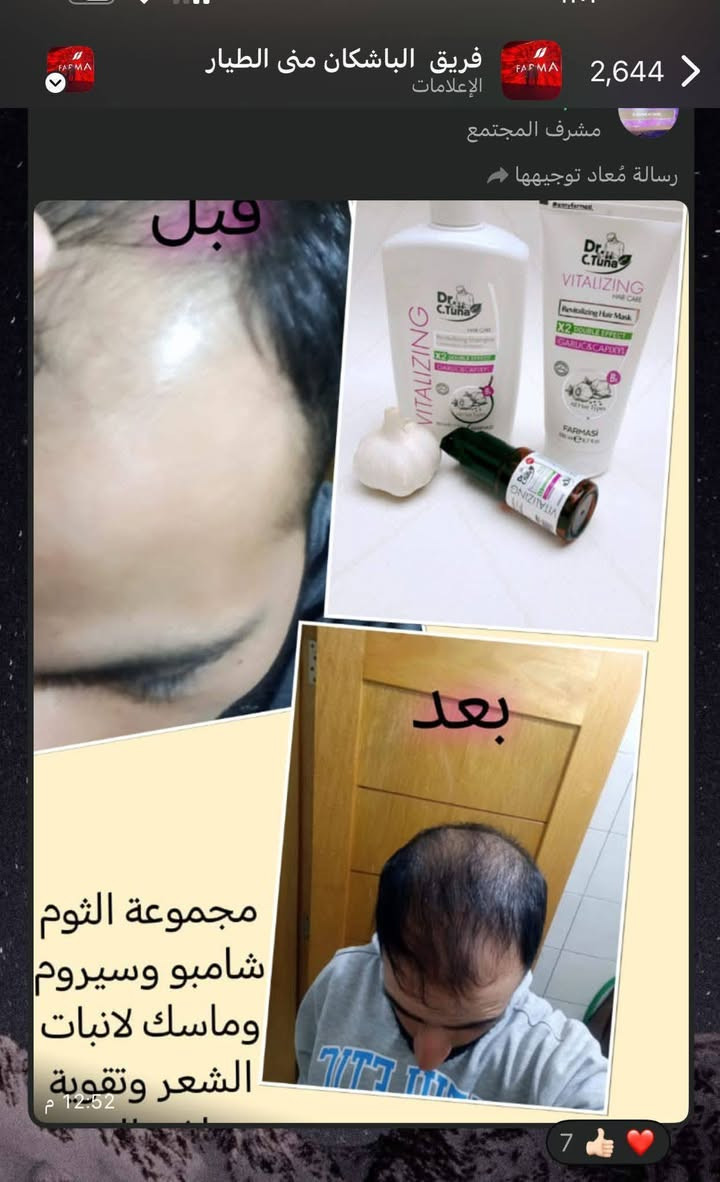 *زيت #الثوم من د سي توناFRMASI* 

⭐يُسهم في تقوية نمو الشعر، وزيادة بصيلاته، وبالتالي الحدّ من مشكلة تساقطه. 
⭐يحتوي على كثيرٍ من المعادن والفيتامينات المُغذّية للشعر، والتي تزيد من ترطيبه وكثافته ولمعانه. 
⭐يُساعد على تنشيط الدورة الدموية في فروة الرأس وزيادة نمو الشعر فيه لأنه يحتوي على مركب الأليسين. 
⭐يُساعد على حماية فروة الرأس من القشرة، والتخلّص منها. 
⭐يحتوي على فيتامين C الذي يُساهم في المحافظة على صحة الشعر ولمعانه.
⭐يقوّي جذور الشعر ويزيد من كثافتها. 
⭐يُساهم في علاج #تقصّف الشعر. 
⭐يعد مُعالجاً جيداً لجفاف الشعر. 
⭐يُساهم في زيادة #طول الشعر وسماكته.


**إذا كنت صاحب هذا الإعلان وتريد حذفه لأي سبب، رجاءا أرسل رسالة إلى الدعم الفني**