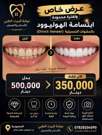 ابتسامة هوليوود • المحمودية • عرض العيد