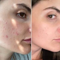 سيروم سنتيلا • SKIN1004 • ترطيب