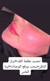 دكتوره ايرانيه • جراحة • ابو رمانه