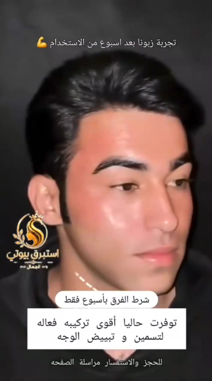 سر النضارة والإشراقة صار بين يديكِ! ✨
نفخر بتقديم أقوى تركيبة طبيعية متوفرة حالياً للعناية بالبشرة، المصممة خصيصاً لتمنح وجهكِ المظهر الممتلئ، الحيوي، والمشرق الذي تستحقينه.
​🔗 النتائج تتحدث عن نفسها! شاهدوا فرق العناية الحقيقية.
💬 للحجز والاستفسار، أرسلي رسالة إلى الصفحة الآن واحصلي على استشارتكِ


**إذا كنت صاحب هذا الإعلان وتريد حذفه لأي سبب، رجاءا أرسل رسالة إلى الدعم الفني**