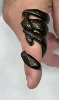 حجامة • طب عشبي • مركز حاجي هيوا