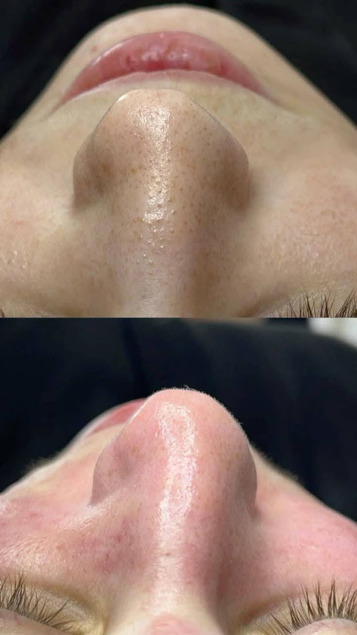 اهلا وسهلا   رمضان كريم عروض  نار
عروض مميزه💃🏻🎊
اسعارناً مناسباً 📍✨
عروض العيد
اوقات العمل خلال فترة رمضان 
من وره صلاة الضهر وبعد افطار
عروس حنه وزفه 200💃🏻💃🏻💃🏻
فقط زفه 100🎈💃🏻
فقط حنه 75🎎🔥🎉🎊🎈💃🏻
المدعوات 15🎊💃🏻🎈🎈
تنظيف البشرة هايدرو 5ب💃🏻🎊
تنظيف البشرة ملكي ب15🎉
تنظيف  اليد 5🥳💃🏻💃🏻💃🏻💃🏻💃🏻
حفافة 5
شمع للوجه  7
بديكير 10مع املاح طبيعية 
الماكير 20🎈🎈🧸
سحب لون شعر 10 الطويل جوه خصر ب15
صبغ شعر قصير جداً 15💃🏻🎎🔥المتن 20وسط 25 الطويل حسب طول الشعر 
ميش كثيف قصير 20 فما فوق حسب طول الشعر 🎎🔥💃🏻
تسريح الشعر يخلي شعرج سرح حسب طول الشعر 
قص 5 اي قصه 
معالج لترميم وتغذية الشعر القصير 20 فما فوق حسب طول الشعر🎉🎊🎈
اهلا وسهلا بلجميع 
صالون الروان 
العنوان//كربلاء قنطرة السلام  صالون الروان 
الحجز //***********
