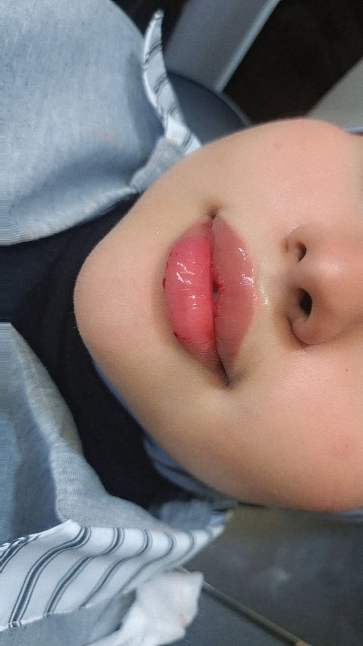 عرض لمدة يومين فقط سعر سيسي  50 الف ع ضمان الماده 
للحجز ***********
