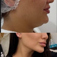 تقنية 4M – تغيّر شامل للوجه ✨ حصريًا عند الدكتورة مروه عادل كاظم لأول ...