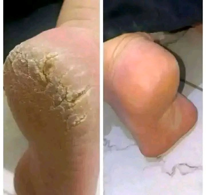 راهم بروموسيو وتوصيل باطل


**إذا كنت صاحب هذا الإعلان وتريد حذفه لأي سبب، رجاءا أرسل رسالة إلى الدعم الفني**