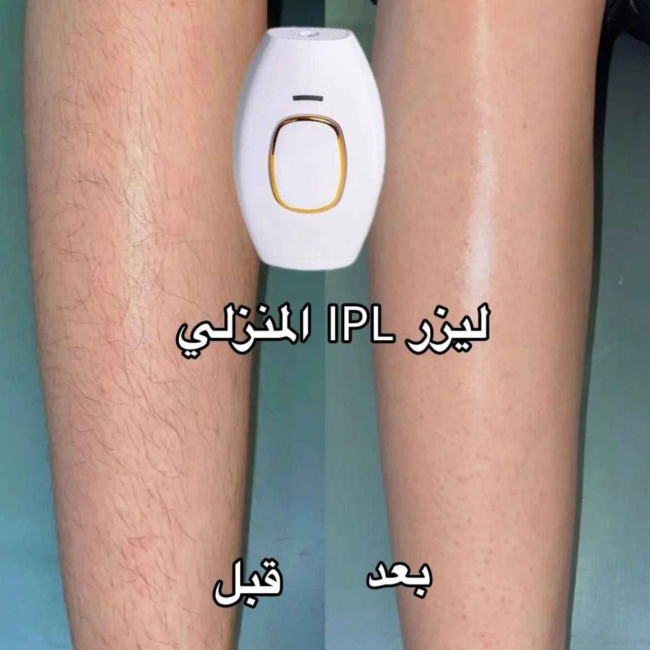 جهاز الليزر ipl المنزلي
لازالة الشعر من شركة IPL العالـمية 
هذا هو الحل النهائي لكل مشاكل الشعر الزائد
لازالة الشعر عبر الومضات الضوئية 
عبر جهاز lPL الليزري 

يحقق نتائج دائمة آمنة وفعالة
▪️افضل طريقة للحصول على جلد املس
▪️يحتوي على مليون ومضة ضوئية 
▪️آمنه لازالة الشعر بشكل دائم
▪️مميزات IPL ليزر Hier Removal
▪️يستخدم للنساء والرجال 
▪️شكل انيق وحديث مميز سهل التشغيل 
▪️تقنية رونيش التي تعمل على توحيد لون البشرة
▪️انها امنة وغير مزعجة
▪️نسبة الاثار الجانبية فيها (0%)

صار عليه عرض حاليا 125 البصرة, العراق


**إذا كنت صاحب هذا الإعلان وتريد حذفه لأي سبب، رجاءا أرسل رسالة إلى الدعم الفني**