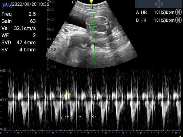 السلام عليكم
جهاز سونار للبيع مع كافة ملحقاته للاستفسار الاتصال على هذا الرقم ‭٠٧٨٠ ١٦٢ ٢٥٩٠‬

