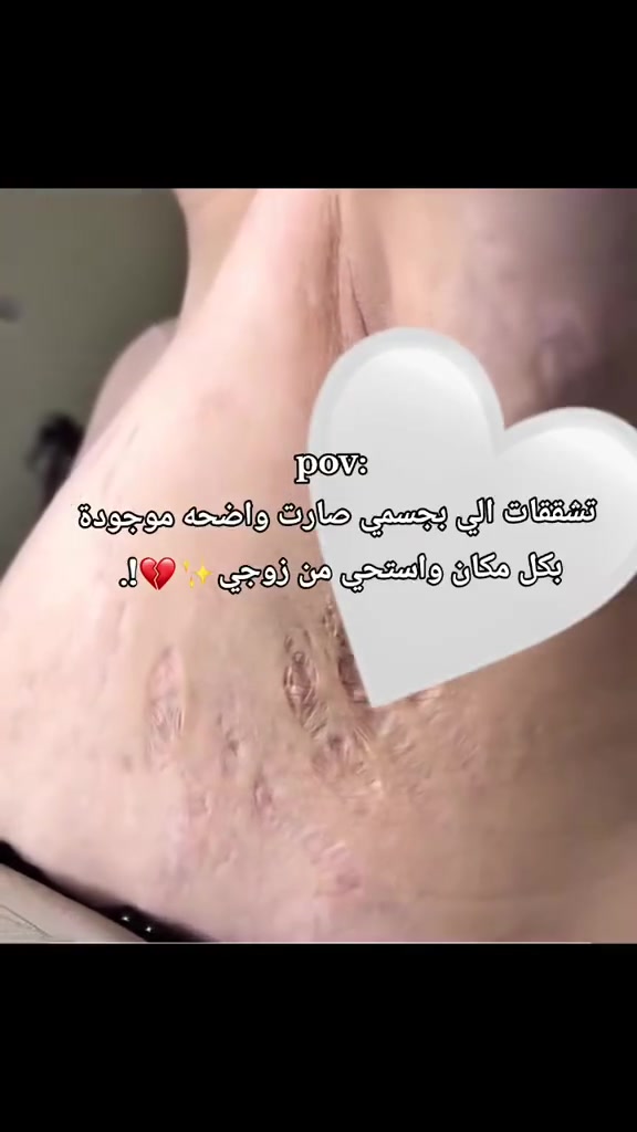 متوفر خدمه توصيل لجميع المحافظات العراق 🚘


**إذا كنت صاحب هذا الإعلان وتريد حذفه لأي سبب، رجاءا أرسل رسالة إلى الدعم الفني**