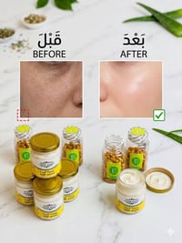 باكيج تسمين • خميرة البيرة • فيتامين E