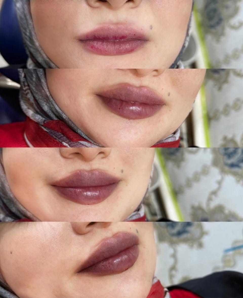 اليوم مسابقتنا غييير ❤️‍🔥❤️
صاحبة الصورة الي تحصل اكثر عدد من اللايكات 
تفوز ويانا بجلسة نضارة الريفتا مجانية❤️
شوفو الصور وسوو لايك
وسوو تاك لصديقاتكم يفوزوكم😍
كل فترة اختار كم صورة نسوي عليهم مسابقة حتى يفوزون مراجعاتنا الدائمات❤️❤️❤️😍


**إذا كنت صاحب هذا الإعلان وتريد حذفه لأي سبب، رجاءا أرسل رسالة إلى الدعم الفني**