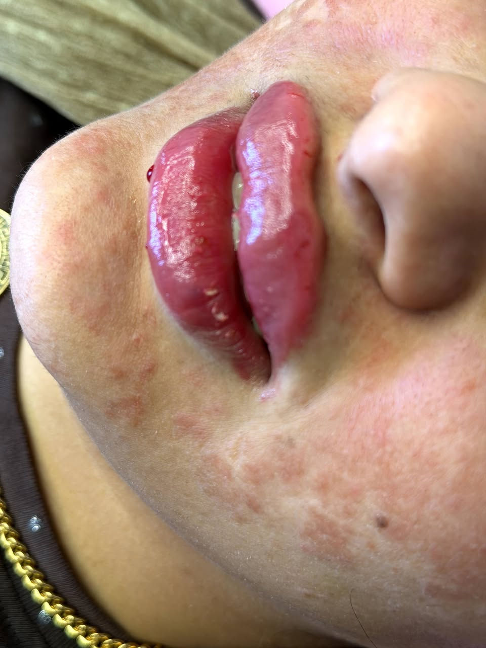 ‏✨شغلي بالتجميل مو بس مهنة✨…هو فن🥰
‏يبرز جمال كل وحدة بطريقة ناعمة ومميزة.😍
‏أهتم بأدق التفاصيل، لأن الجمال الحقيقي يكمن في البساطة والإتقان.
‏#عيادةالدكتورةنبأمكي 😍
‏لطب وتجميل وزراعة الأسنان🦷
‏والحقن 💉والتجميل اللاجراحي🩹💉
‏احجزي موعدك وخلي جمالك يحكي لكِ 🤍
‏
‏📍العنوان_الأعلام شارع البدالة_ مجمع القمة الطبي
‏☎️ ***********
‏
