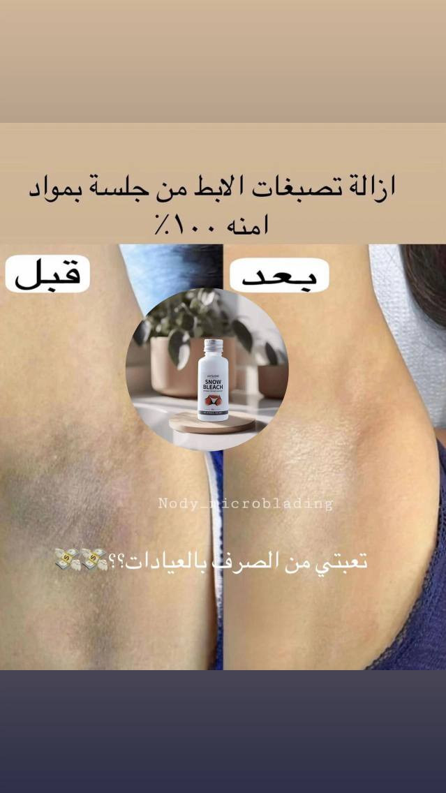 كريم عملاق التفتيح الفائق💎 ✨SNOW BLEACH ✨
احصلي على بياض الثلج خلال ثلاث ايام❄️❄️
• منتج طبيعي وامن للمناطق الحساسه وتحت الابطين 
وصل اليوم عملاق التبييض وتفتيح الوجه والمناطق الحساسة من شركة SNOW BLEACH
كريم التبييض  المصنوع من مكونات نباتية طبيعية 100%، يحتوي على نياسيناميد وفيتامين C   ومستخلص آسياتيكا والبابونج وغسول تجديد البشرة 

✅ يستخدم للمناطق الحساسة وتحت الابط والكوع والركبة وبين الافخاذ 
منتج اصلي💯 انتبهوا نزل منه تقليد الغطاء مختلف ❌
السعر خاص
🚘 يوجد خدمة توصيل لجميع محافظات العراق  🚘 بغداد, العراق


**إذا كنت صاحب هذا الإعلان وتريد حذفه لأي سبب، رجاءا أرسل رسالة إلى الدعم الفني**