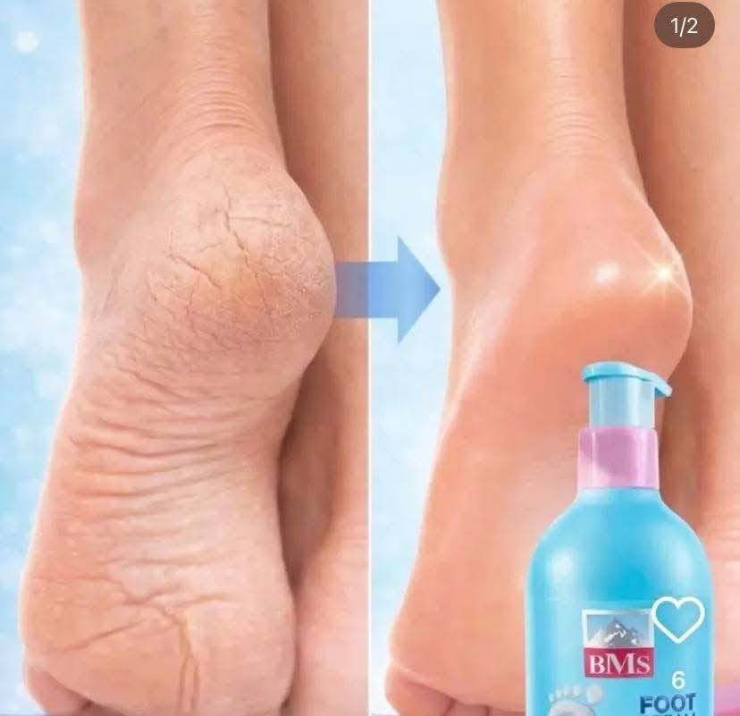 وصل الجمالات😍😍 مباشر من إيران الي 🤭
تره بالصيف نحتاج ترطيب اكثر لان تصير تشققات وجفاف 
بنات الي حاجزه تتفضل خاص 🤗🤗
قطع محدوده 👇


**إذا كنت صاحب هذا الإعلان وتريد حذفه لأي سبب، رجاءا أرسل رسالة إلى الدعم الفني**