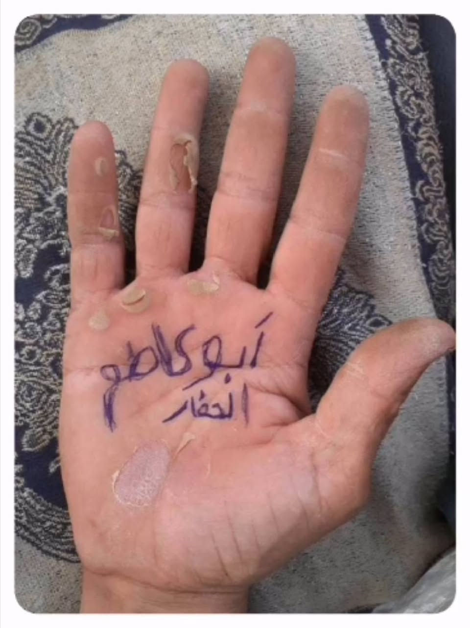 من رخصه الادمن إلي عنده شغل جفره قديمه طايح سقفها انضفها وأرجع اصبها ***********
