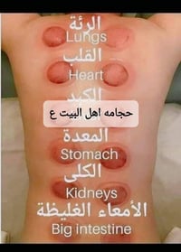 حجامه اهل البيت عليهم السلام نهاية شارع السوداني 07902799452