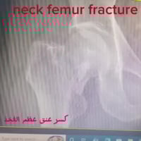 طوزخورماتو • أخصائي عظام • تبديل المفاصل