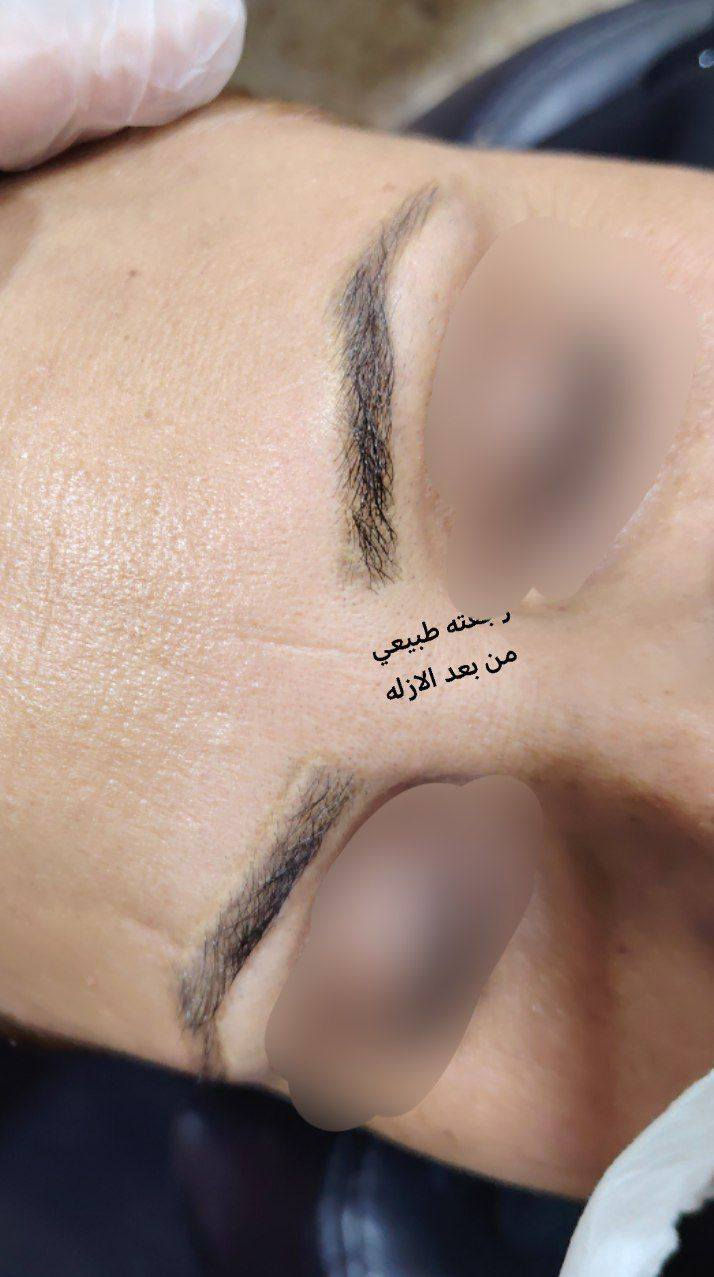 والاستفسار على الواتساب 👈 ***********
عروض مستمره لجميع انواع (آلتہآتہؤ)
وزلاله المسح تہآتہؤ//الغير مرغوب بي 

استغلن العروض  
والاستفسار على الواتساب 👈 ***********

السماوه حي الحسين خلف مطعم بوليفارد----المدربة التاتو ام محمد
صالون ورده؟🥀🥀🥀بغداد 
؟-----------------------------

؟-----------------------------
