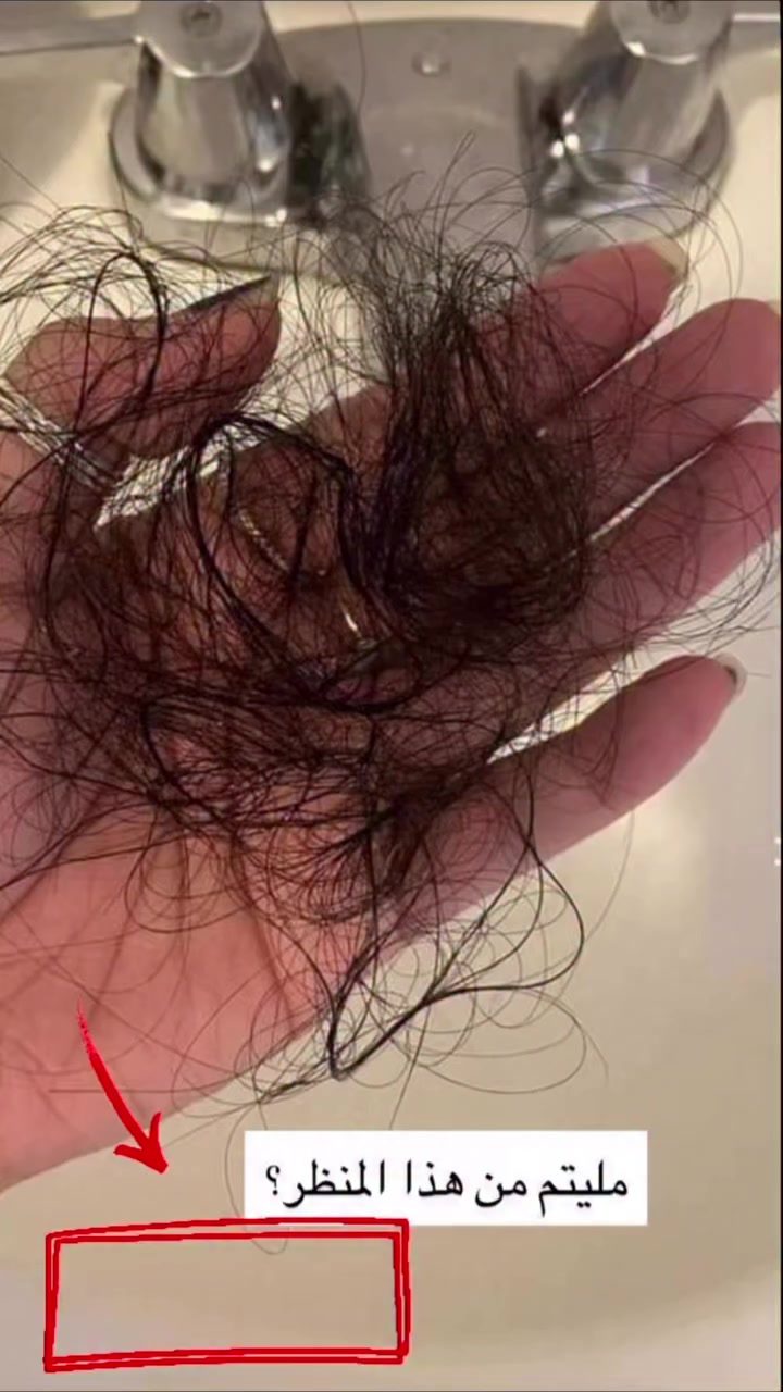 🌿 باكج اكليل الجبل 🌿

الحل النهائي لتساقط الشعر وملأ الفراغات اقوى واسرع علاج طبيعي لأنبات البيبي هير
يتكون من..
١_ شامبو اكليل الجبل
٢_ زيت اكليل الجبل
٣_ تونك بخلاصة اكليل الجبل المائيه
٤_ كريم جوز الهند الاصلي والطبيعي لتغذيه وتنعيم الشعر
٥- مشط توزيع الزيت ع الشعر
٦_فرشاة لتدليك فروة الرآس وتنشيط جذور الشعر
السعر {{ 32 الف }}
توصيل 🚚 بغداد والمحافظات 5  الاف 🚗

#zoza_secret #زوزه_سيكرت #منتجات_طبيعية #العراق #بغداد


**إذا كنت صاحب هذا الإعلان وتريد حذفه لأي سبب، رجاءا أرسل رسالة إلى الدعم الفني**