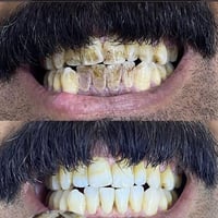 تنظيف مجاني • إشراف طبي • واتساب