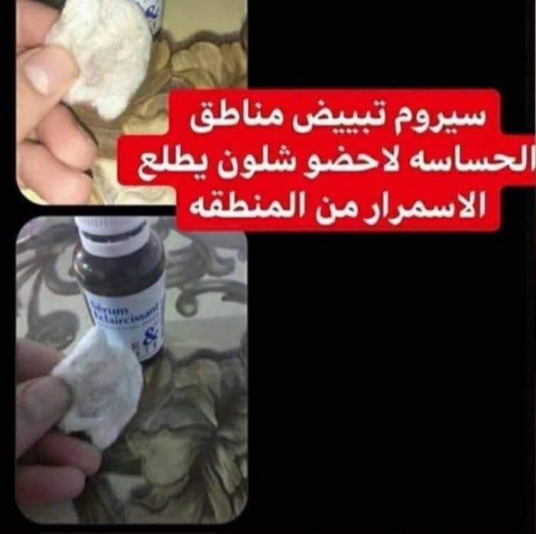 يوجد اكثر من عشر انواع كوبي للسيروم الفرنسي بالاسواق والبيجات والقنوات ❌❌
الاصلي يمنه #الاصلي 
سيروم تبييض مناطق الحساسه الفرنسي الاصلي 💯 🇫🇷💥💥
سيروم فرنسي يعالج تصبغات المناطق الحساسه يعمل على طبقات الجلد ويقشر الجلد الميت بعد 4 ايام من الاستخدام 
السيروم مجموعه زيوت ترطب وتبيض وكثير بنات يسالوني استخدمته 3 ايام ويطلع اثر قليل بلقطنه؟؟ يطلع اثر قليل هذا معناه السيروم بدا يشتغل 

هذا مواد تقشير يحتاج وقت يلا يزيل الجلد وبنفس الوقت مرطب  يعني يزيل الجلد بدون احمرار 
السيروم هذا يعالج ويزيل التصبغات ويغنيج عن كثير منتجات 
بس هيه مو يومين كل منتج تستخدميه بانتظام ورا اسبوع يلا يشتغل ويبين مفعوله ليش!!
لان الجلد يحتاج وقت حتى يستجيب ويبدي يتغلغل على طبقات الجلد ويقشرها وهو مرطب بنفس الوقت يعني هذا السيروم اختصار للمقشر والكريم بعلبه وحدة ✔️✔️✔️
الاستعمال قطنة وتقطرين ع القطن 
وتستخدميه بشكل يومي
  
#متوفر الأصلي كما موضح بالصور
⭕️ انتباه لكثرة الانواع والتقليد بلاسواق انتبهوا رجاءا الي عدنا فقط الاصلي الفرنسي 🇫🇷🇫🇷💯💯
السعر خاص
وشررط الاصلي 

#عنايه_تبيض

@إشارة


**إذا كنت صاحب هذا الإعلان وتريد حذفه لأي سبب، رجاءا أرسل رسالة إلى الدعم الفني**