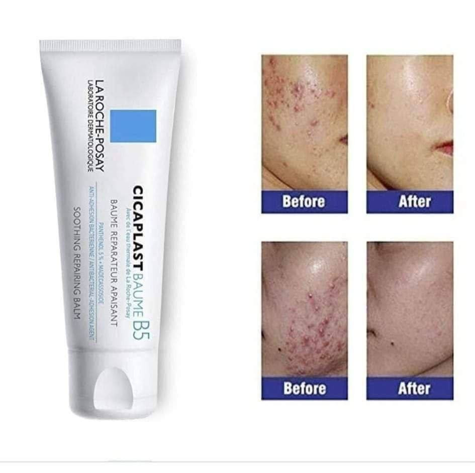 ‏💙+CICAPLAST_BAUME_B5 
من شركة لاروش بوزية 
وفرنا لكم كريم سيكا بلاست الاصلي متعدد الاستعمالات 

✅كريم سيكا بلاست من لاروش بوزيه الفرنسيه 🇫🇷 
✅ لإصلاح وتهدئة وحماية البشرة من (التهيج ،التشقق ، 
البقع الخشنة ). 
✅لترميم البشرة وحمايتها من الجفاف ما بعد الليزر 
وبعد التقشير. بعد الديرما بن او ديرما رولر 
✅يستخدم لتهدئة تهيجات البشرة بعد جلسات (الديرمابن والديرما رولر و بعد الهيدرافيشيال) . 
✅ تقدري تستخدميها ك ترطيب للبشره الجافه اللي ماينفعش معاها الترطيب العادي. 
✅يمكن تطبيقها على الجسم والوجه 😘 
✅مناسبة جداً للبشرة الحساسة 
✅ مفيد جدا لجلد الوزة ولازالة كافة انواع الندب ع الجلد واثار الجروح 
والحروق وحفر الوجه واثار حب الشباب المستعصية 
واثار العمليات الجراحية  والتشققات الجلدية 
يرمم البشرة بشكل سريع  خلال فترة بسيطة 🤗
المنشأ فرنسي 🇫🇷 بغداد, العراق


**إذا كنت صاحب هذا الإعلان وتريد حذفه لأي سبب، رجاءا أرسل رسالة إلى الدعم الفني**