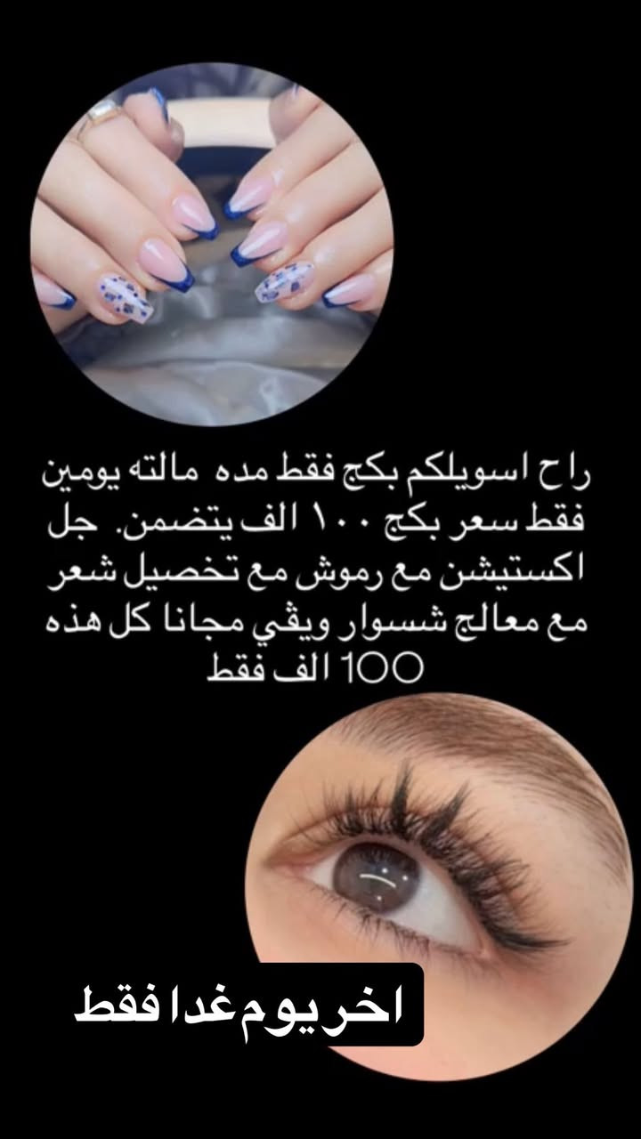 الدوره حي الصحه مقابل شمس بركر للحجز ‭٠٧٧٢ ٩٠١ ٩٧٠٠‬
