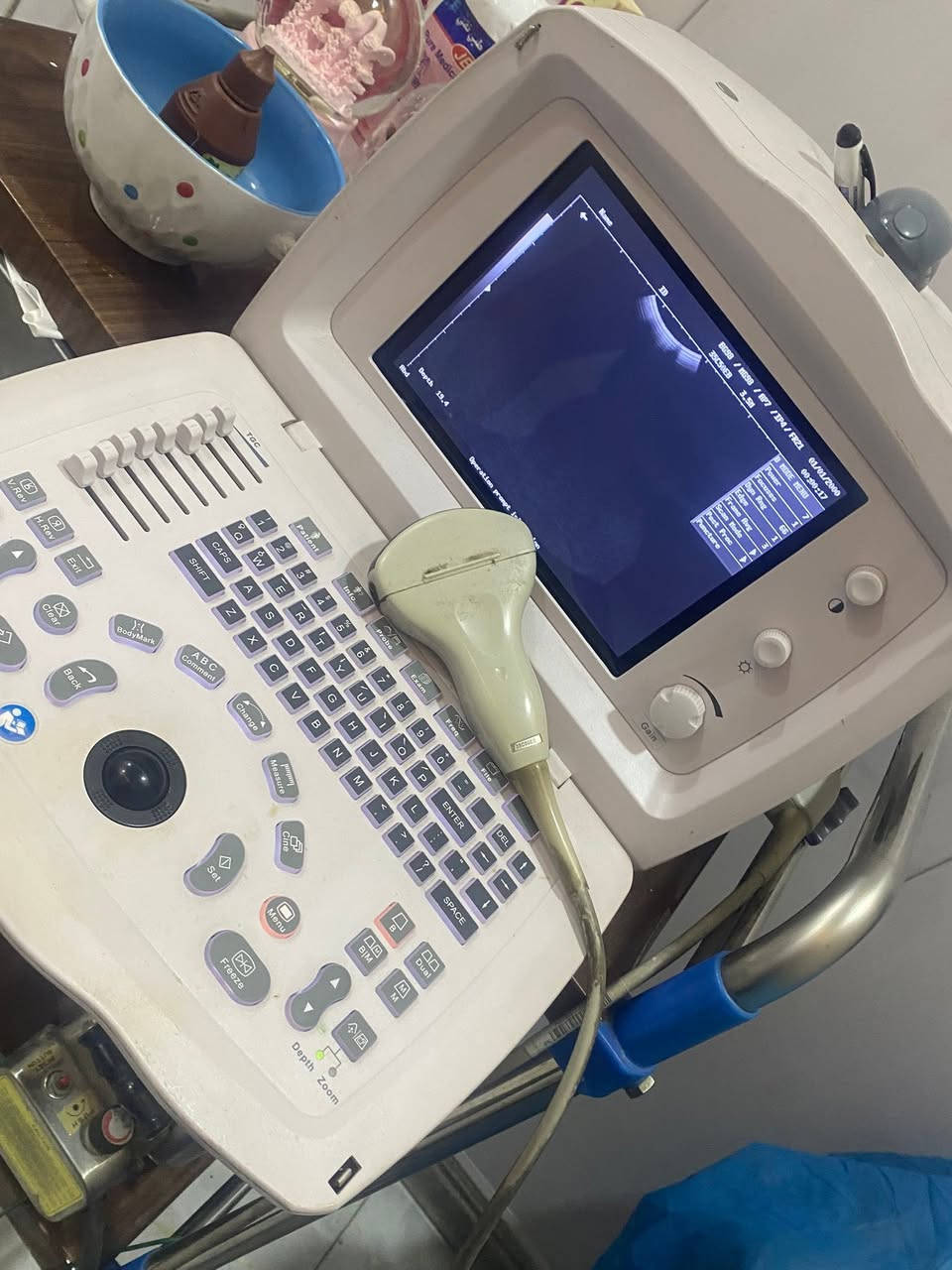 السلام عليكم 
جهاز سونر PD2200 plus للبيع
من شركه مندري


**إذا كنت صاحب هذا الإعلان وتريد حذفه لأي سبب، رجاءا أرسل رسالة إلى الدعم الفني**
