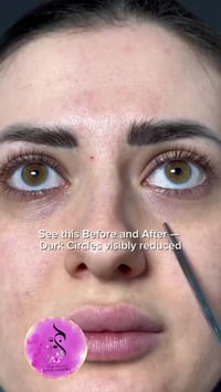 نومبوزين رقم ٩ • NAD+ ريتينول • ٥٠ ببتيد