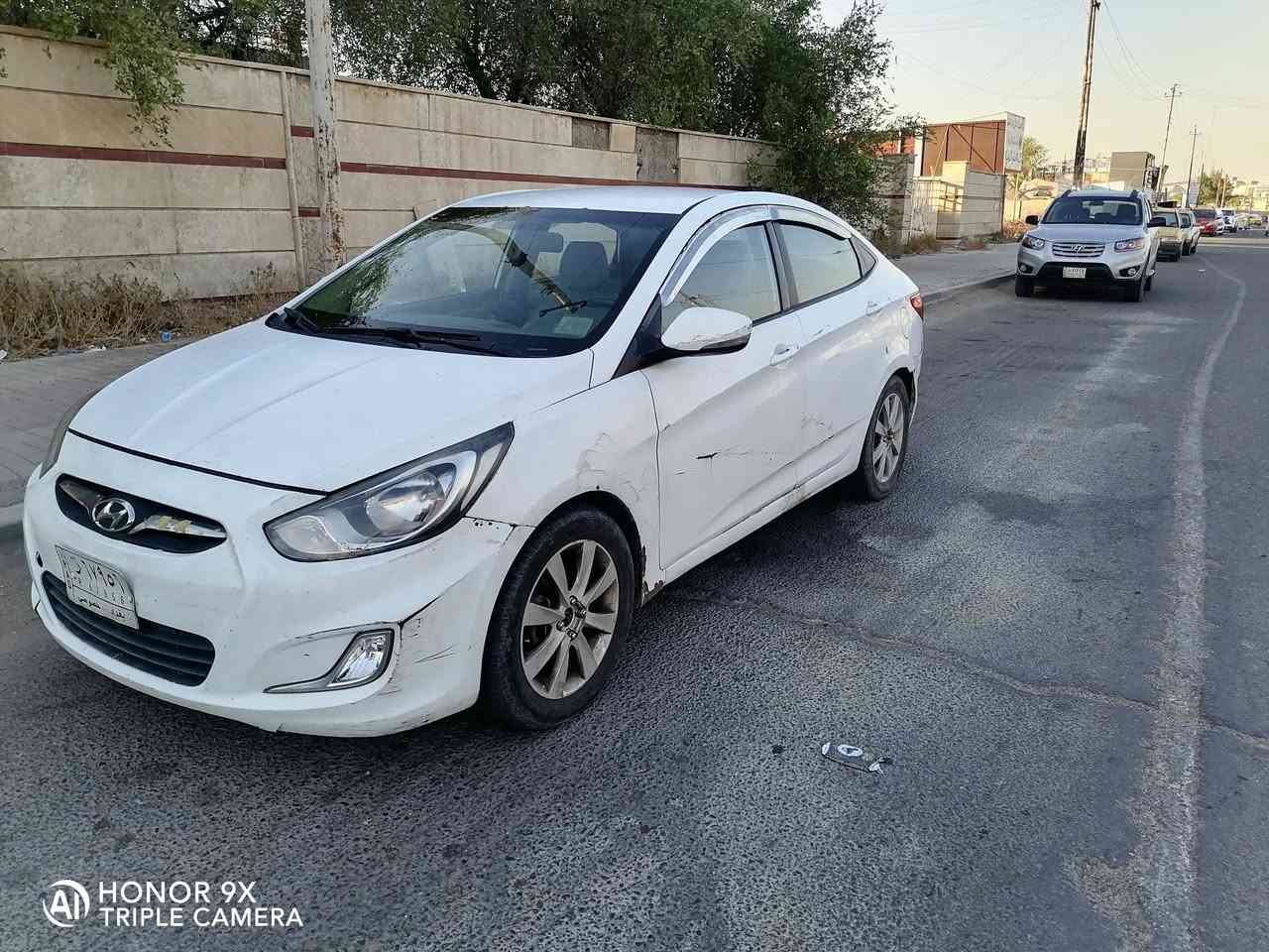السلام عليكم اكسنت خليجي ٢٠١٤ محرك ١٦٠٠ قطرتين الكشر بي ملاحظات طخات باقي السيارة ميكانيك كهربائيات كلها تمام تبريد ثلج عارضها (75) عنوان بغداد سبع أبكار
***********
السلام عليكم اكسنت خليجي ٢٠١٤ محرك ١٦٠٠ قطرتين الكشر بي ملاحظات طخات باقي السيارة ميكانيك كهربائيات كلها تمام تبريد ثلج عارضها (75) عنوان بغداد سبع أبكار
