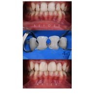 عيادة أسنان • حي الموظفين • نظام أقساط