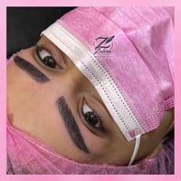 تقنية المكثف • تجميل • مراسلة دايركت