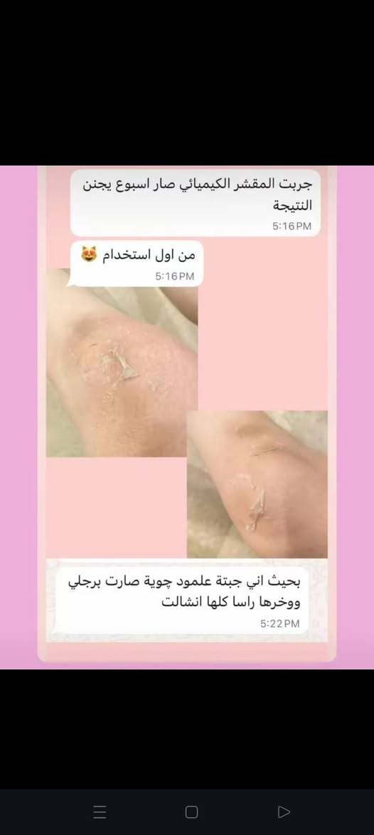 بنات متوفره لدينا مادة تقشير كاربوني 
توفرررت لدينا للحجز والاستسفسار مراسلتي خاص ***********
