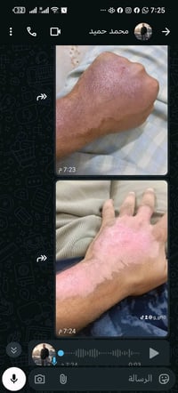 هذا عرض لمنتج جلد مصنوع من مواد طبيعية، مناسب لمن يعاني من مشاكل في ال...