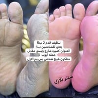 يهنئكم سنتر الأزل بمناسبه  حلول عيد الفطر المبارك... واكيد بعروض حلوه ...