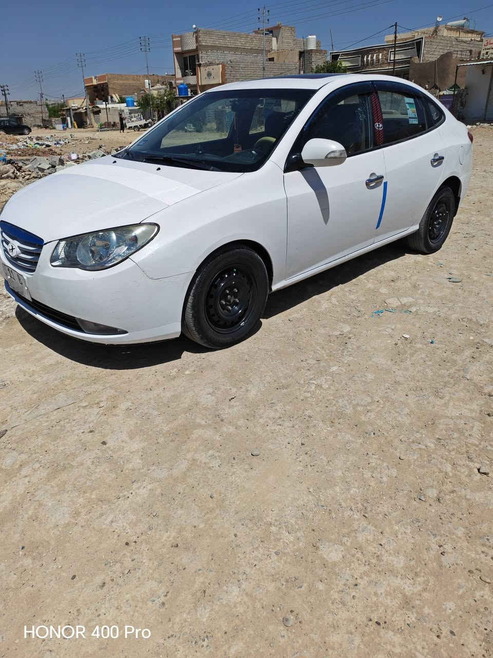 النترا موديل 2011 محرك 2000 لا تنقيص ولا تبخير رقم بغداد
تبريد بستم محور 
صورة السونار بالمنشور
***********
ديالى بعقوبة
