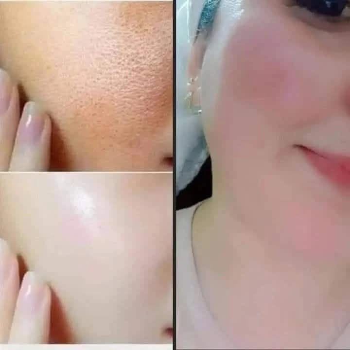 رجعت توفرت خلطة نور الشام السورية 🌷🌸🌷 الخلطة والصابونة لتبيض الوجه وتصفيتة من التصبغات العنيدة والنمش وحب الشباب واثار حب الشباب 
بتعالج بسامير الوجه والهالات السوداء لتحت العين 
ومع الضمان خلال أسبوع واحد بتلاحظو الفرق 
للطلب خاص او واتس اب ***********
متوفر خدمة توصيل لكافة محافظات العراق 🚗🚗
