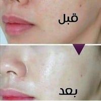عصارة نيويورك • صابونة نيويورك • تفتيح