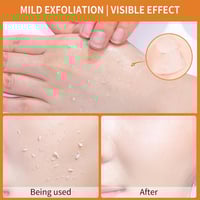 جل تقشير برتقالي • مقشر الوجه • نعومة فورية