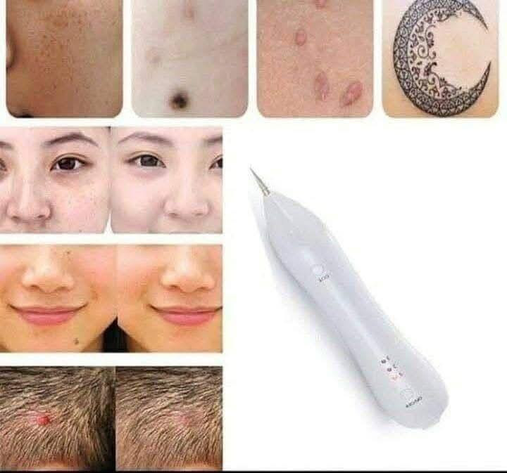 😍 جهاز ازاله النمش والتاتو والشام  😍
👈 اليوم جبيتلكم الجهاز الاكثر نجاح واكثر سهولة ومابي اي خطورة جهاز ازالة الشام والنمش واللحم الزائد  الي  يكون محلو على البشرة او بالجسم  او اي وشم تاتو تريدون تتخلصون منة هذا الجهاز راح يزيلة 👉
💡طبعا هذا الجهاز شي سحري وعجيب🤩 ويستخدم استخدام منزلي 🏘️ 
🤗السعر 15000
  
  الحجز خاص


**إذا كنت صاحب هذا الإعلان وتريد حذفه لأي سبب، رجاءا أرسل رسالة إلى الدعم الفني**