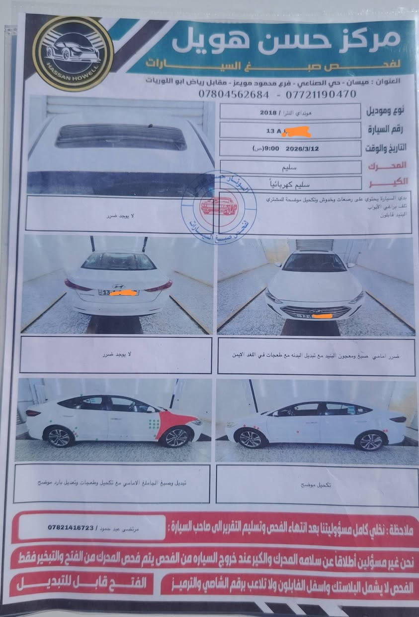 السلام عليكم
الانتره  خليجي مكينه 2000 دوش

 فول موصفات عدا بصمه

 رقمها انكليزي ميسان 2018

تبديل جاملغ  الأمامي و طخات بسيطه فقط

مثل ماوضح بالسونار  السعر المطلوب 122

وبيها مجال... الاستفسار  اتصال بالرقم ***********
