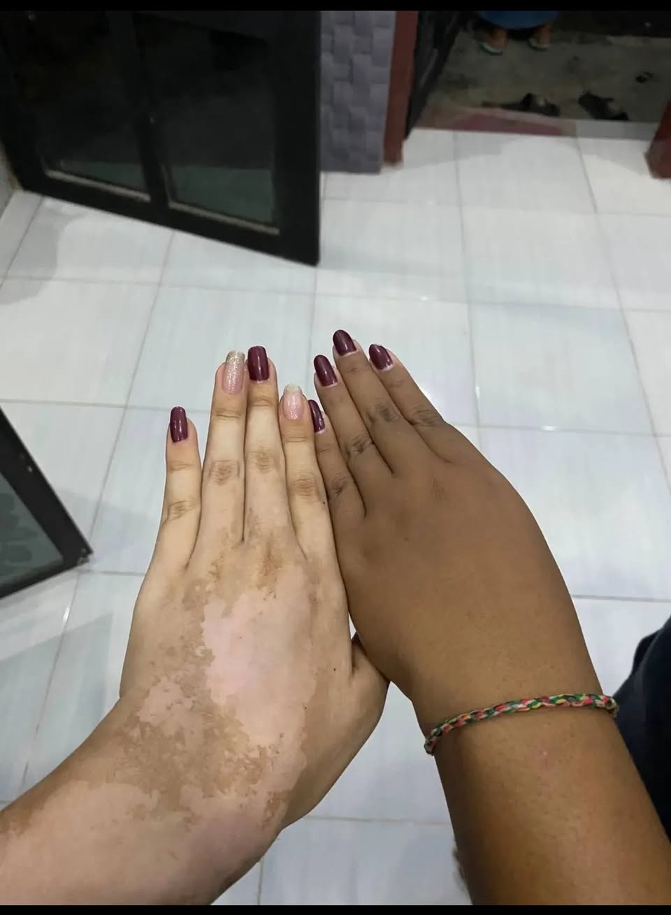 #عرض_لمدة_أسبوع توصيل مجاني لكل المحافظات 🚚  فقط رشي على الجسم وخليه دقيقة وبعدها افركي وشوفي شكد بشرتچ تصير أنعم وأحلى بالملمس 😍  يساعد يزيل الجلد الميت ويخلّي البشرة تبين أصفى وأنعم ممتاز للركب، الأكواع، القدمين، وكل الجسم ✨  يُستخدم 2–3 مرات بالأسبوع ضمن روتين العناية 🎀  اكتبي (تم) ونرسل لج التفاصيل 💌


**إذا كنت صاحب هذا الإعلان وتريد حذفه لأي سبب، رجاءا أرسل رسالة إلى الدعم الفني**