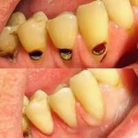 دكتور اسنان • رمضان مجاني • الحله شارع 40