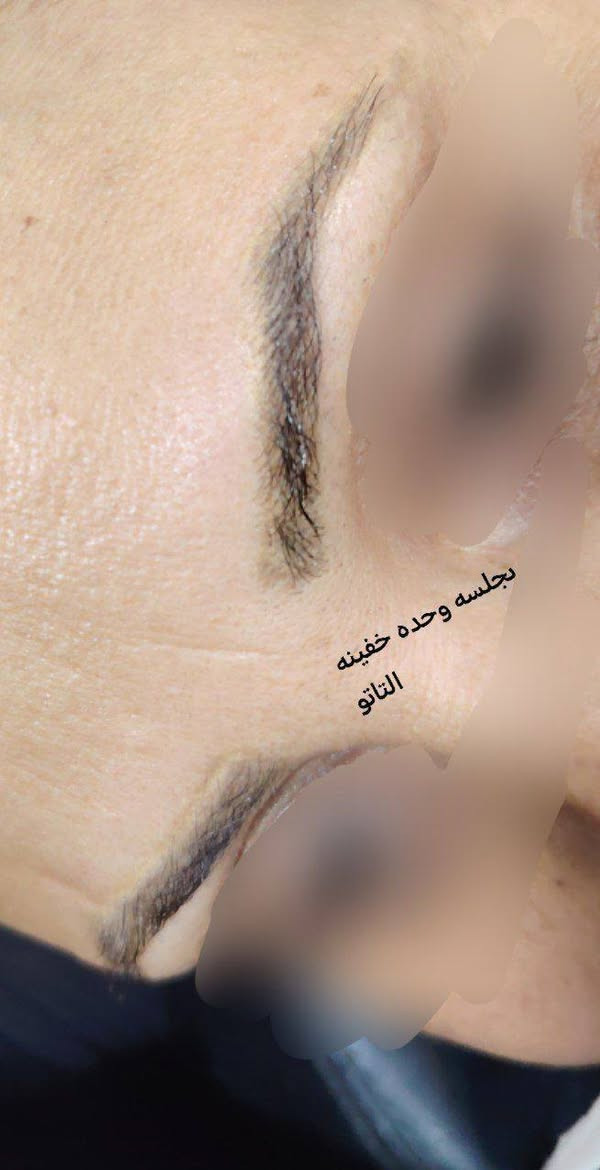 والاستفسار على الواتساب 👈 ***********
عروض مستمره لجميع انواع (آلتہآتہؤ)
وزلاله المسح تہآتہؤ//الغير مرغوب بي 

استغلن العروض  
والاستفسار على الواتساب 👈 ***********

السماوه حي الحسين خلف مطعم بوليفارد----المدربة التاتو ام محمد
صالون ورده؟🥀🥀🥀بغداد 
؟-----------------------------

؟-----------------------------
