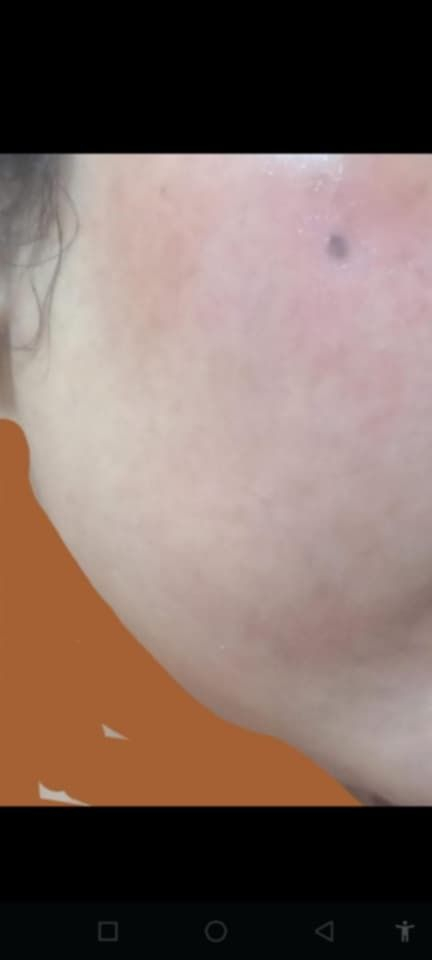 اللهم صلي على محمد وآل محمد 

خلطه تبيض ونضاره العجيبه خلال يومين تخلي وجه يجننن يوجد توصيل


**إذا كنت صاحب هذا الإعلان وتريد حذفه لأي سبب، رجاءا أرسل رسالة إلى الدعم الفني**