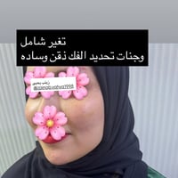 تجميل • حقن • ناصريه مدينه